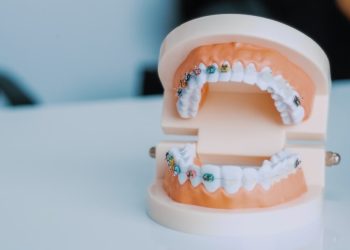 a-close-up-of-a-tooth-model-on-a-table-f6a2zabytum